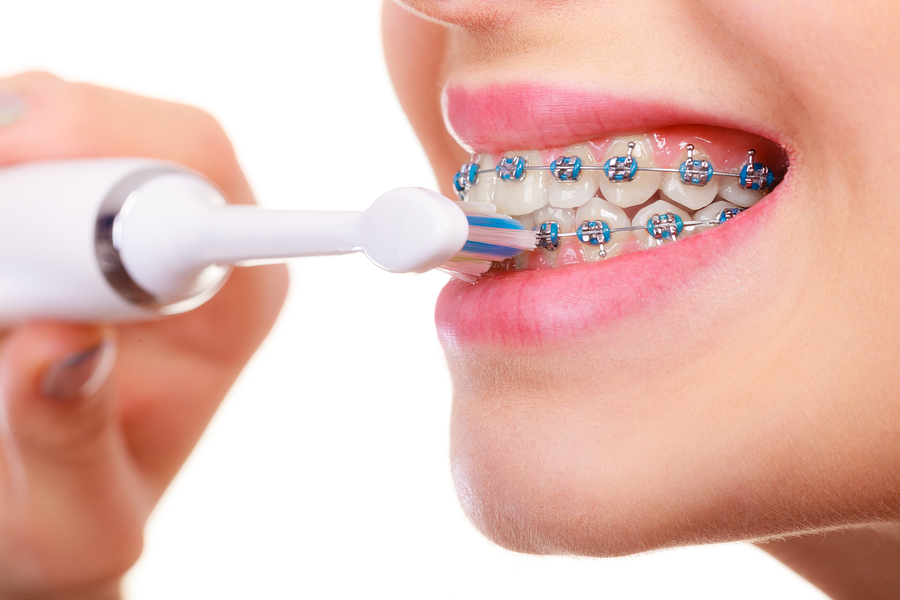 oral health care with braces