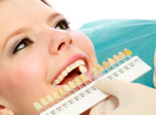 teeth-whitening
